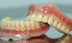 Цинк и кремы для фиксации зубных протезов