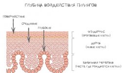 Что мне делать с постакне?